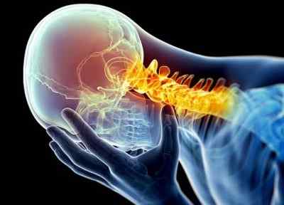 Основные симптомы шейной мигрени