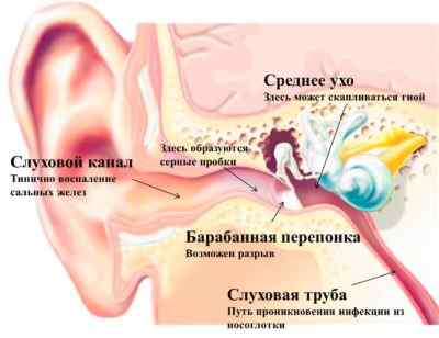 Болит голова в области ушей воспаление в среднем ухе